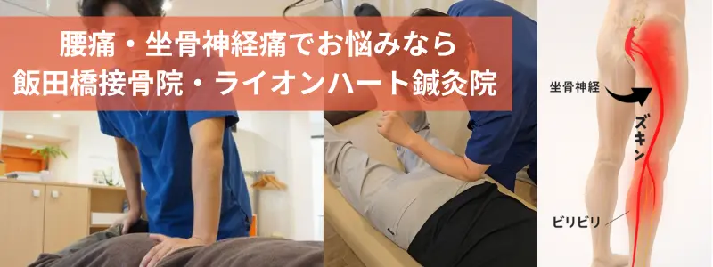 坐骨神経痛のある腰痛を緩和